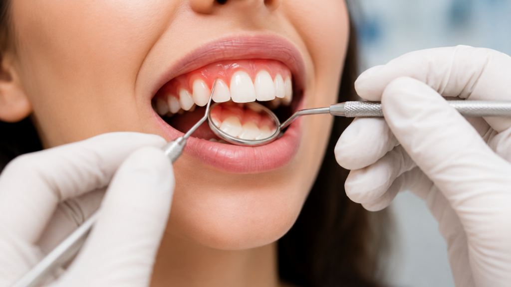 Early Signs of Gum Disease